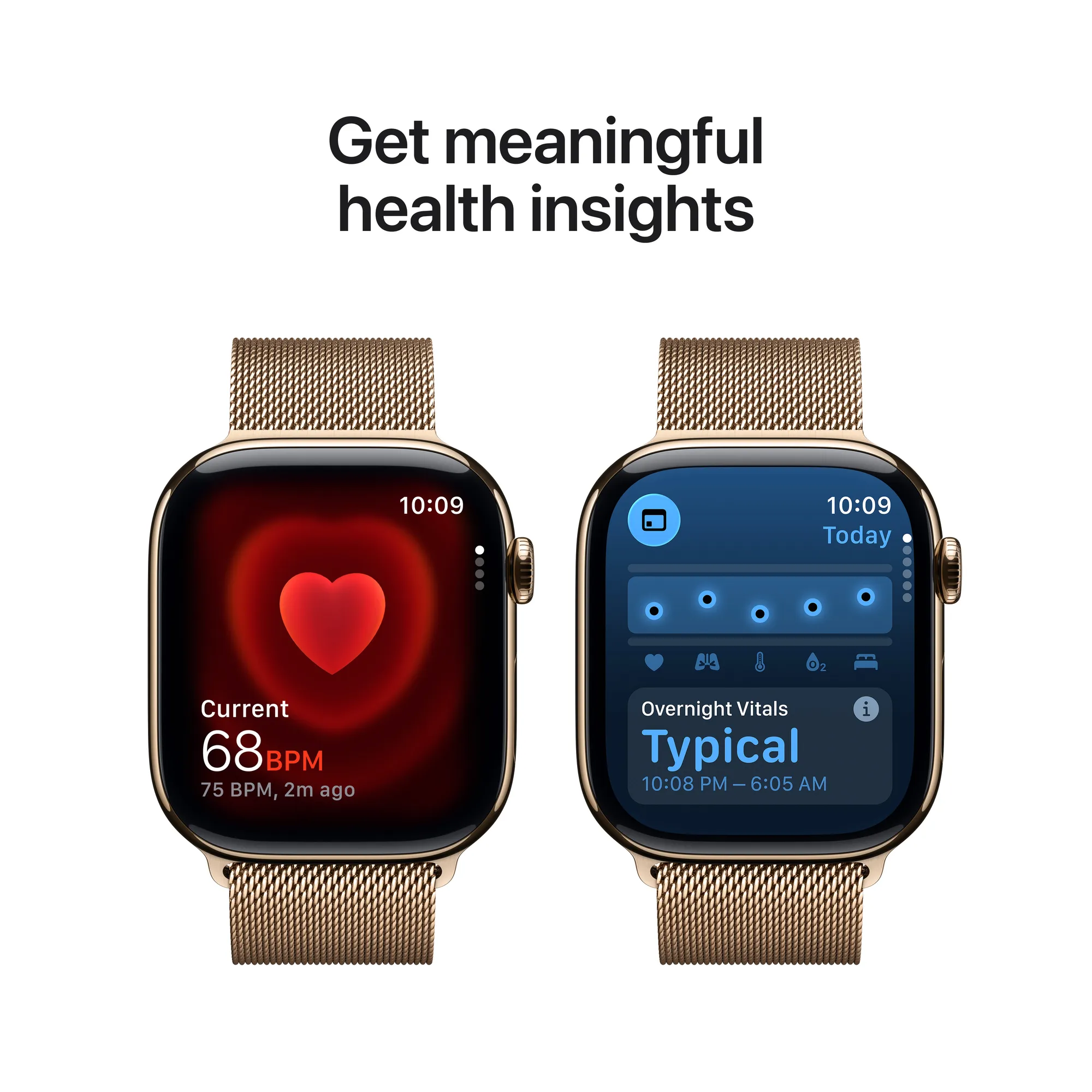 Apple Watch Series 11 GPS + Cellular, 46 mm-es arany titántok, arany milánói szíj – SM
