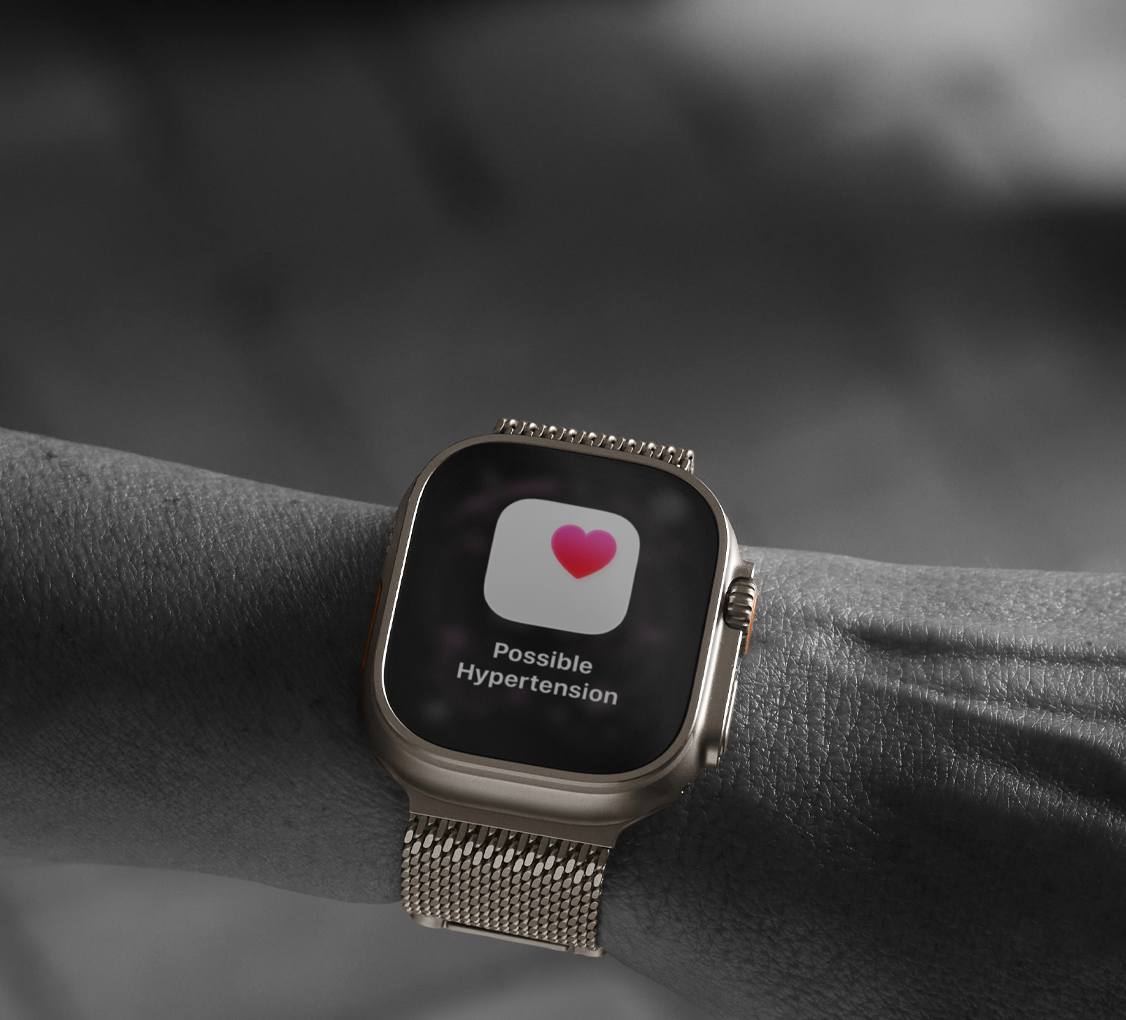 Apple Watch Ultra 3 magas vérnyomás értesítés
